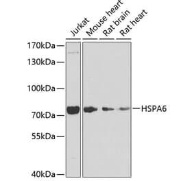 Western Blot - Anti-HSPA6 Antibody (A15840) - Antibodies.com