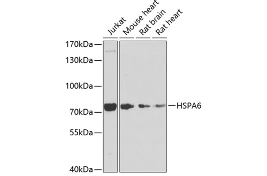 Western Blot - Anti-HSPA6 Antibody (A15840) - Antibodies.com
