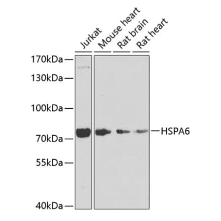 Western Blot - Anti-HSPA6 Antibody (A15840) - Antibodies.com