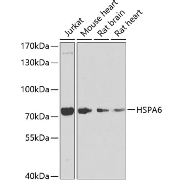 Western Blot - Anti-HSPA6 Antibody (A15840) - Antibodies.com