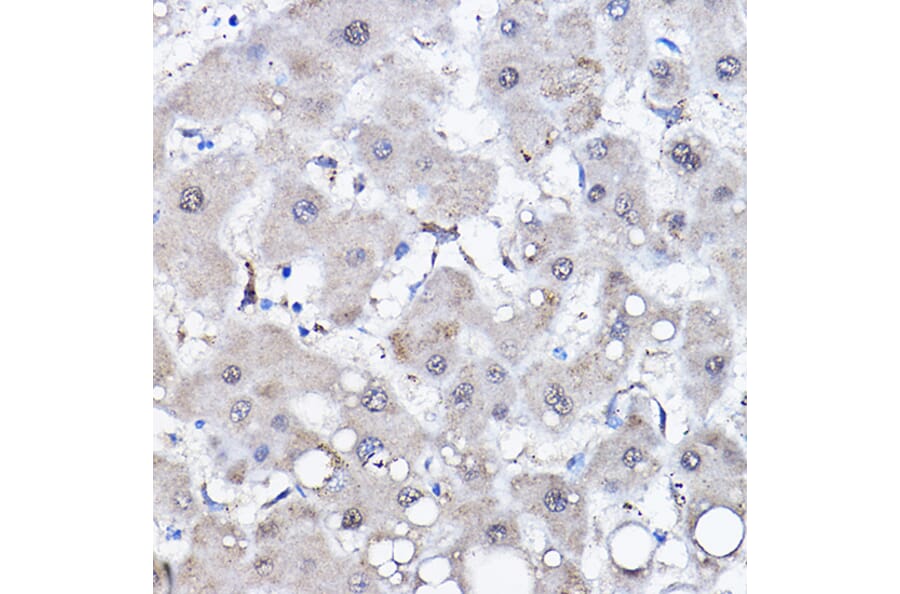 Immunohistochemistry - Anti-HSPA6 Antibody (A15840) - Antibodies.com
