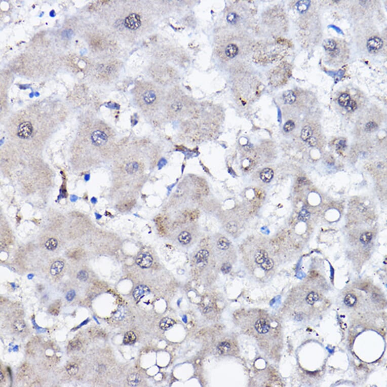 Immunohistochemistry - Anti-HSPA6 Antibody (A15840) - Antibodies.com