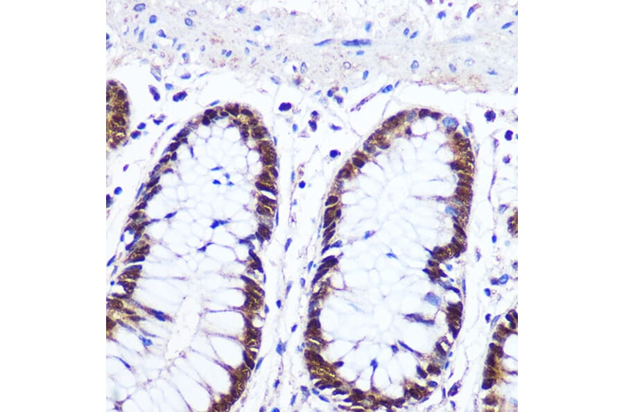 Immunohistochemistry - Anti-IRF1 Antibody (A15842) - Antibodies.com