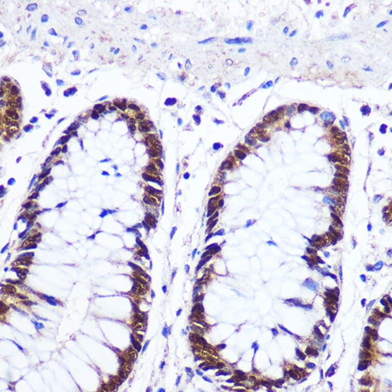 Immunohistochemistry - Anti-IRF1 Antibody (A15842) - Antibodies.com