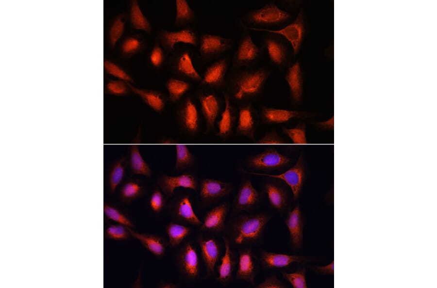 Immunofluorescence - Anti-IRF1 Antibody (A15842) - Antibodies.com