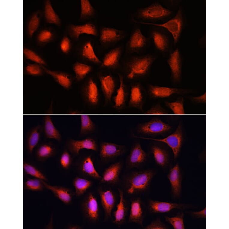 Immunofluorescence - Anti-IRF1 Antibody (A15842) - Antibodies.com