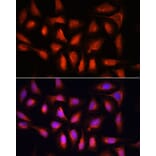 Immunofluorescence - Anti-IRF1 Antibody (A15842) - Antibodies.com