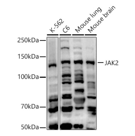 Western Blot - Anti-JAK2 Antibody (A15843) - Antibodies.com