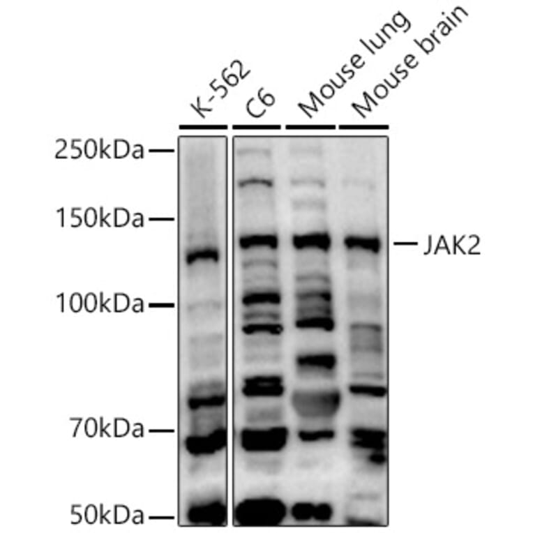 Western Blot - Anti-JAK2 Antibody (A15843) - Antibodies.com