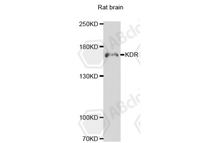 Western Blot - Anti-KDR Antibody (A7695) - Antibodies.com
