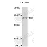 Western Blot - Anti-KDR Antibody (A7695) - Antibodies.com