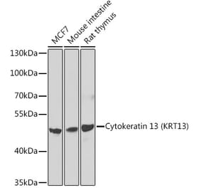 Western Blot - Anti-Cytokeratin 13 Antibody (A15845) - Antibodies.com