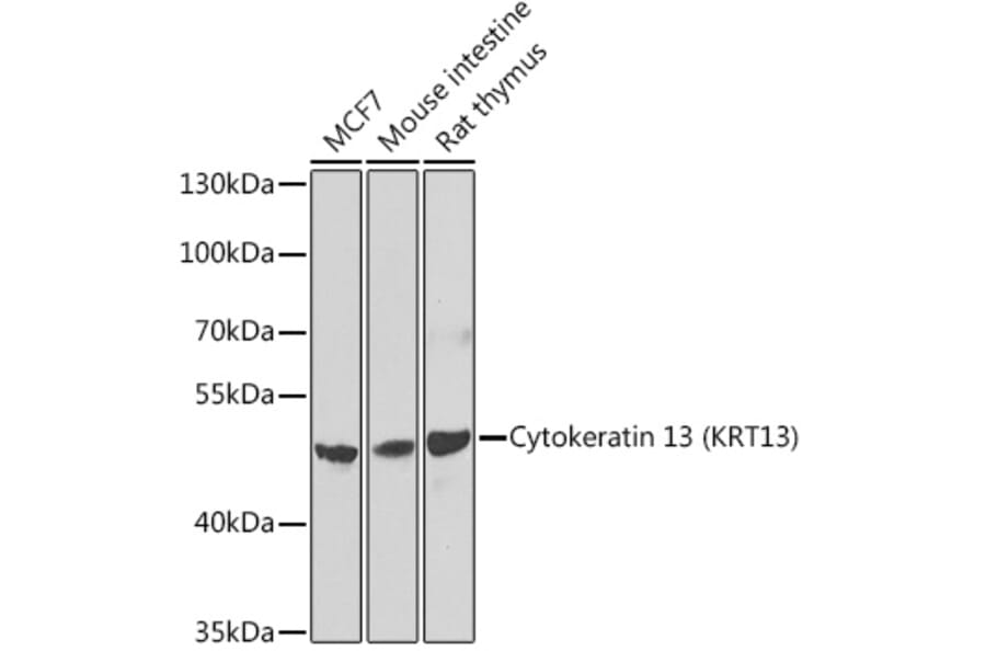 Western Blot - Anti-Cytokeratin 13 Antibody (A15845) - Antibodies.com