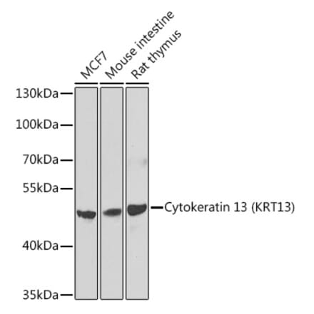 Western Blot - Anti-Cytokeratin 13 Antibody (A15845) - Antibodies.com