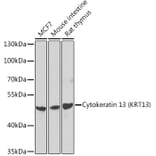 Western Blot - Anti-Cytokeratin 13 Antibody (A15845) - Antibodies.com