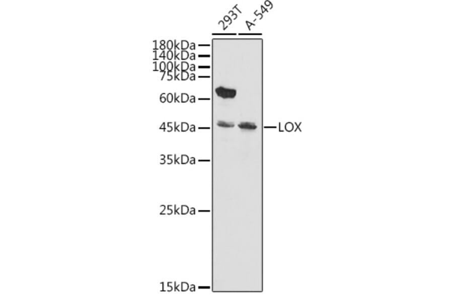 Western Blot - Anti-LOX Antibody (A15846) - Antibodies.com