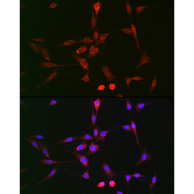 Immunofluorescence - Anti-LOX Antibody (A15846) - Antibodies.com