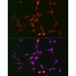 Immunofluorescence - Anti-LOX Antibody (A15846) - Antibodies.com