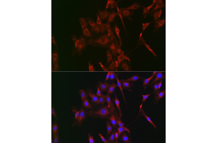 Immunofluorescence - Anti-LOX Antibody (A15846) - Antibodies.com