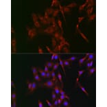 Immunofluorescence - Anti-LOX Antibody (A15846) - Antibodies.com