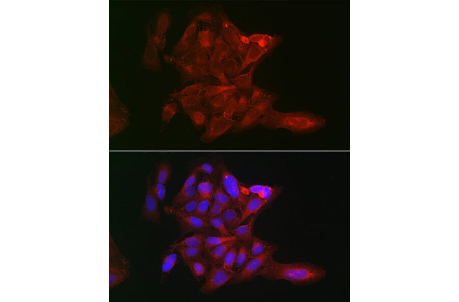 Immunofluorescence - Anti-LOX Antibody (A15846) - Antibodies.com