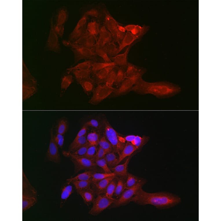 Immunofluorescence - Anti-LOX Antibody (A15846) - Antibodies.com