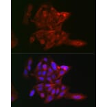 Immunofluorescence - Anti-LOX Antibody (A15846) - Antibodies.com