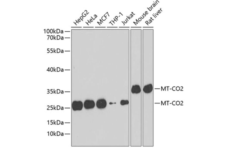 Western Blot - Anti-MT-CO2 Antibody (A7702) - Antibodies.com
