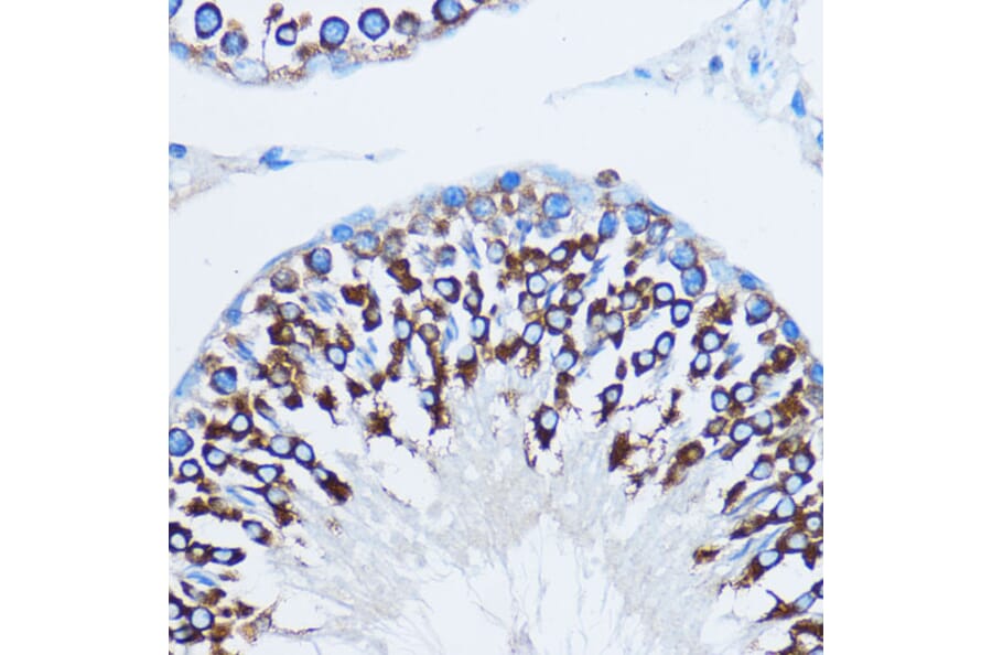 Immunohistochemistry - Anti-YB1 Antibody (A15848) - Antibodies.com