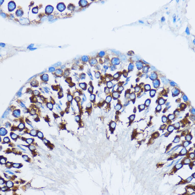 Immunohistochemistry - Anti-YB1 Antibody (A15848) - Antibodies.com