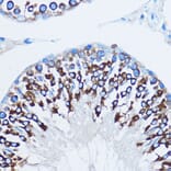 Immunohistochemistry - Anti-YB1 Antibody (A15848) - Antibodies.com