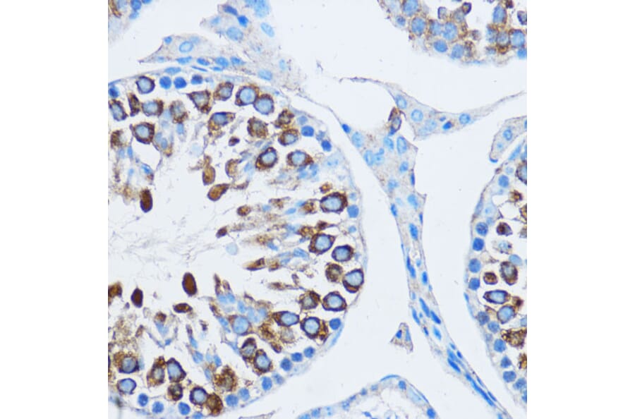 Immunohistochemistry - Anti-YB1 Antibody (A15848) - Antibodies.com