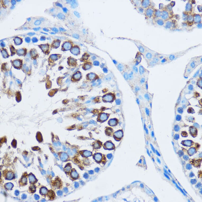 Immunohistochemistry - Anti-YB1 Antibody (A15848) - Antibodies.com