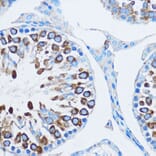 Immunohistochemistry - Anti-YB1 Antibody (A15848) - Antibodies.com