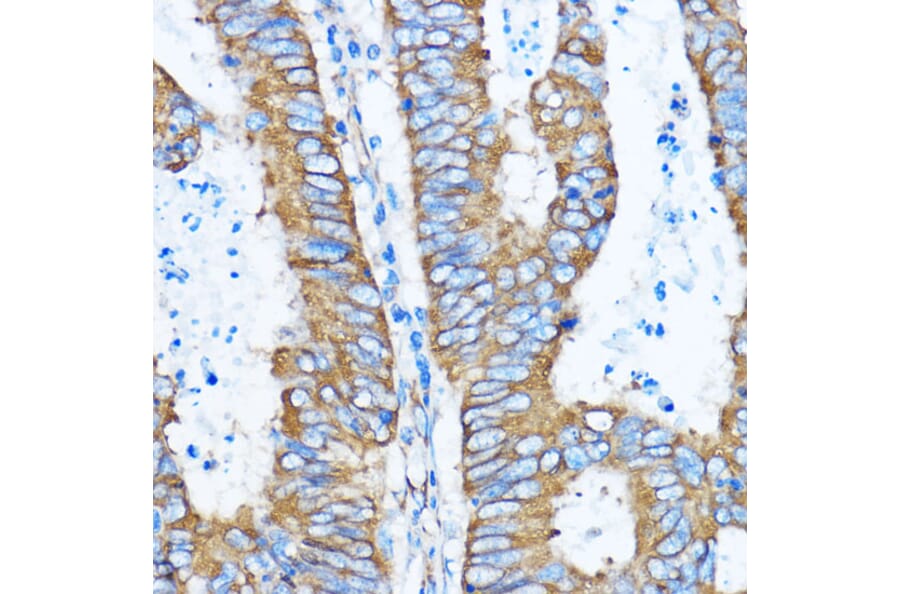 Immunohistochemistry - Anti-YB1 Antibody (A15848) - Antibodies.com