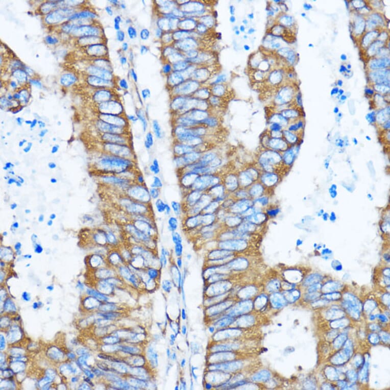 Immunohistochemistry - Anti-YB1 Antibody (A15848) - Antibodies.com