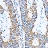 Immunohistochemistry - Anti-YB1 Antibody (A15848) - Antibodies.com