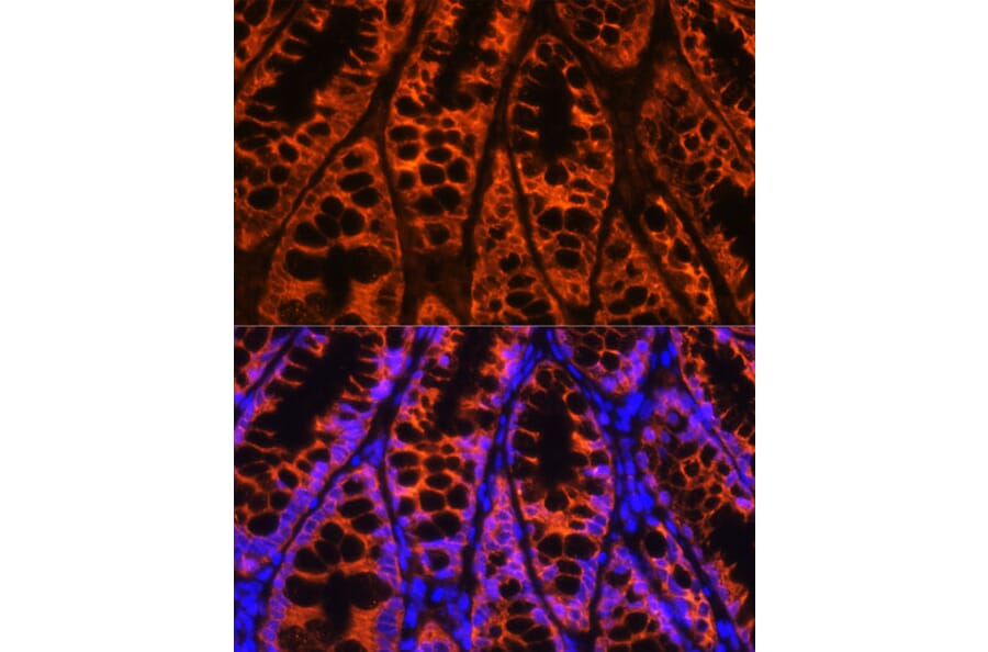 Immunofluorescence - Anti-YB1 Antibody (A15848) - Antibodies.com