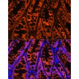 Immunofluorescence - Anti-YB1 Antibody (A15848) - Antibodies.com