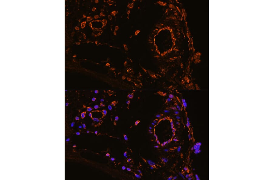 Immunofluorescence - Anti-YB1 Antibody (A15848) - Antibodies.com