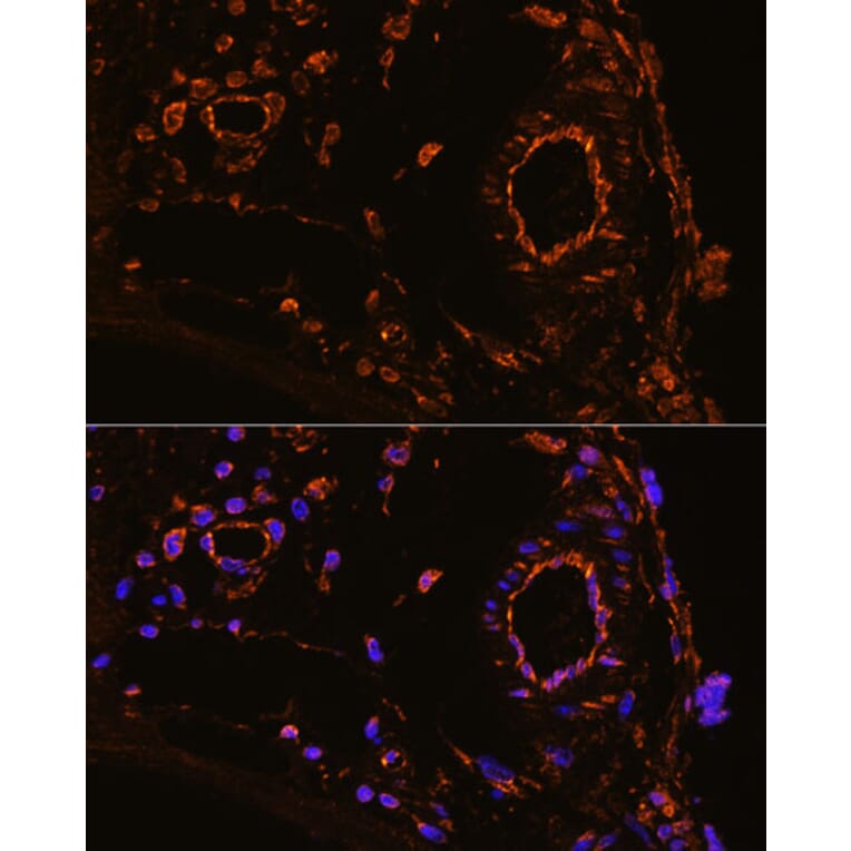 Immunofluorescence - Anti-YB1 Antibody (A15848) - Antibodies.com