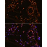 Immunofluorescence - Anti-YB1 Antibody (A15848) - Antibodies.com