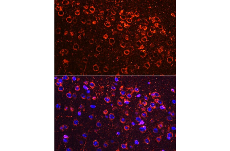 Immunofluorescence - Anti-YB1 Antibody (A15848) - Antibodies.com