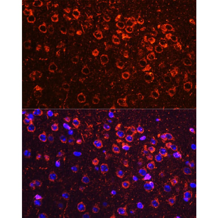 Immunofluorescence - Anti-YB1 Antibody (A15848) - Antibodies.com