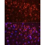 Immunofluorescence - Anti-YB1 Antibody (A15848) - Antibodies.com