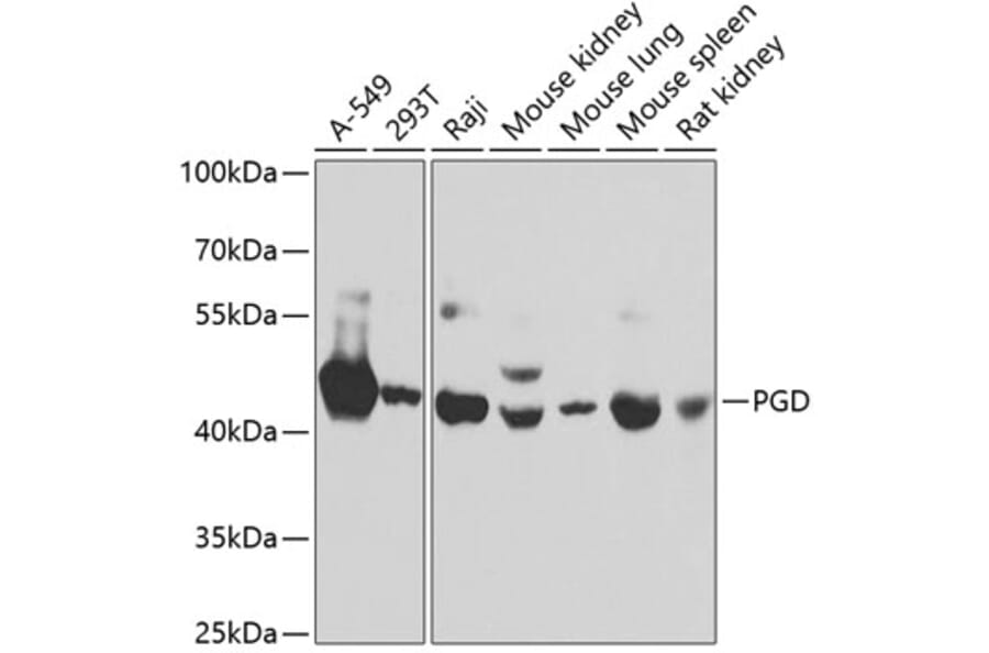 Western Blot - Anti-PGD Antibody (A15849) - Antibodies.com
