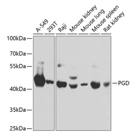 Western Blot - Anti-PGD Antibody (A15849) - Antibodies.com