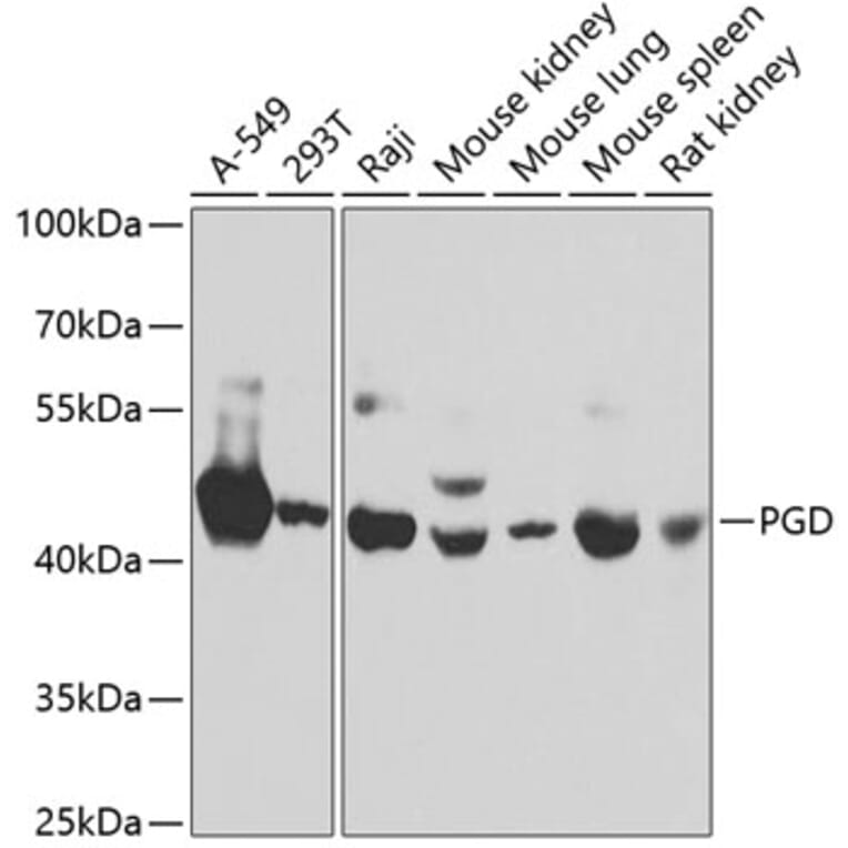 Western Blot - Anti-PGD Antibody (A15849) - Antibodies.com