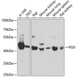 Western Blot - Anti-PGD Antibody (A15849) - Antibodies.com