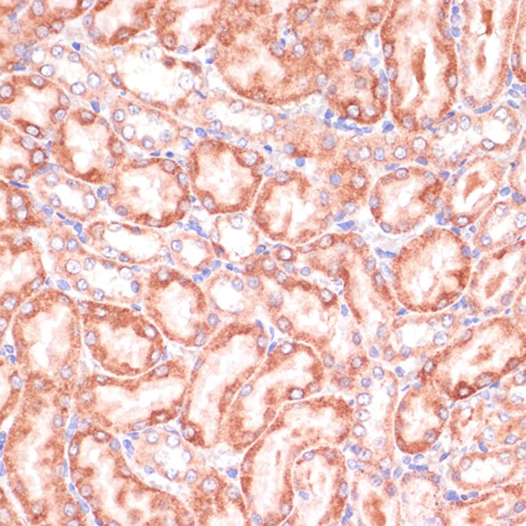 Immunohistochemistry - Anti-PGD Antibody (A15849) - Antibodies.com